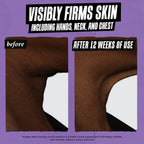 Micro-Dose Anti-Aging Retinol Serum with Ceramides and Peptide