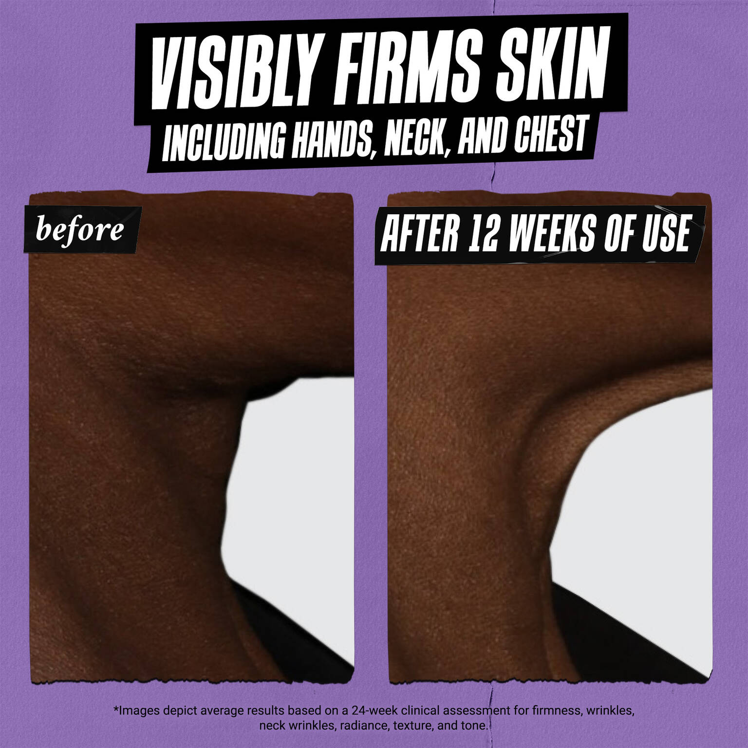 Micro-Dose Anti-Aging Retinol Serum with Ceramides and Peptide