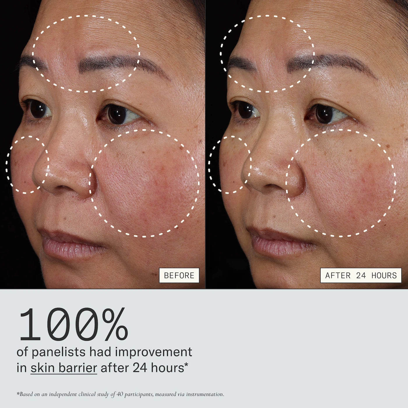 Instant Angel Lipid-Rich Firming Moisturizer
