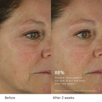 The Dewy Skin Cream Plumping & Hydrating Refillable Moisturizer