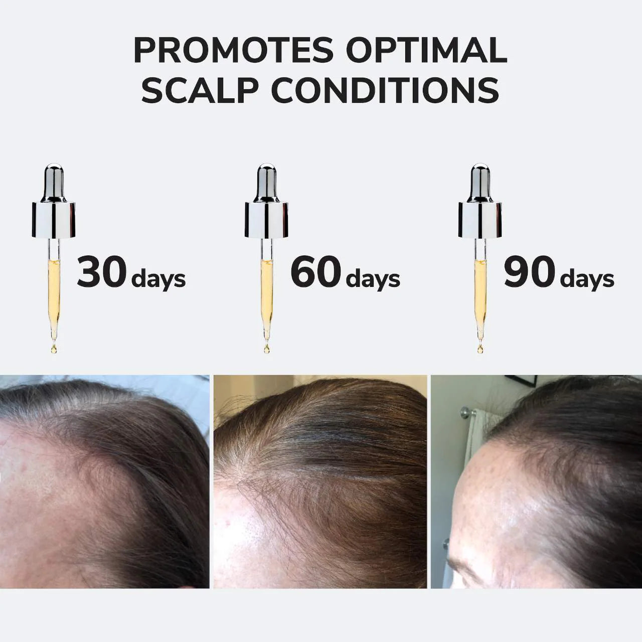 Youth Juice Collagen Scalp Serum for Thinning Hair