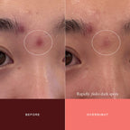 The Mark Advanced Targeted Dark Spot Concentrate with 5% Tranexamic Acid, 1% Alpha Arbutin & 1% Kojic Acid for Hyperpigmentation, Acne Marks & Age Spots