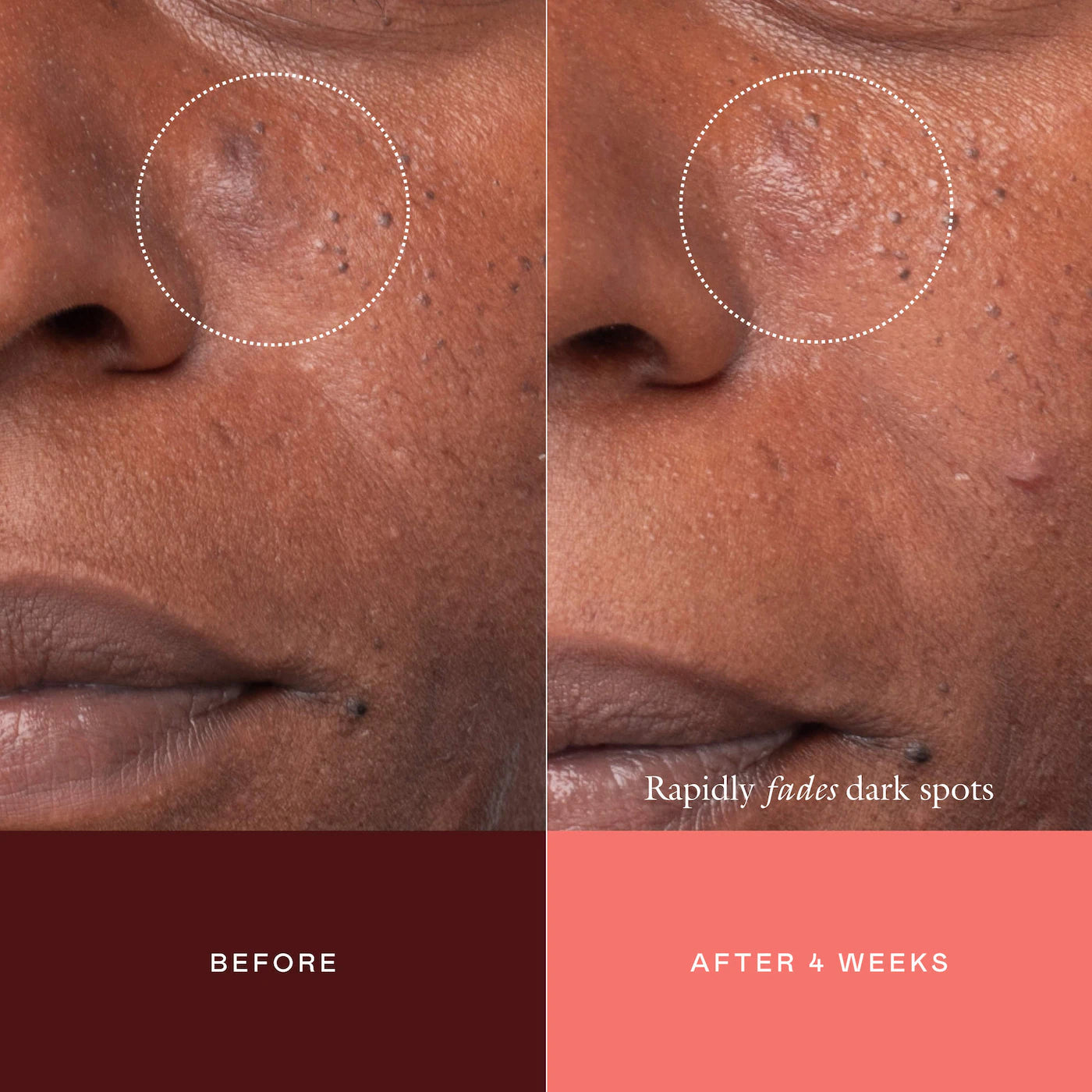 The Mark Advanced Targeted Dark Spot Concentrate with 5% Tranexamic Acid, 1% Alpha Arbutin & 1% Kojic Acid for Hyperpigmentation, Acne Marks & Age Spots