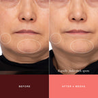 The Mark Advanced Targeted Dark Spot Concentrate with 5% Tranexamic Acid, 1% Alpha Arbutin & 1% Kojic Acid for Hyperpigmentation, Acne Marks & Age Spots