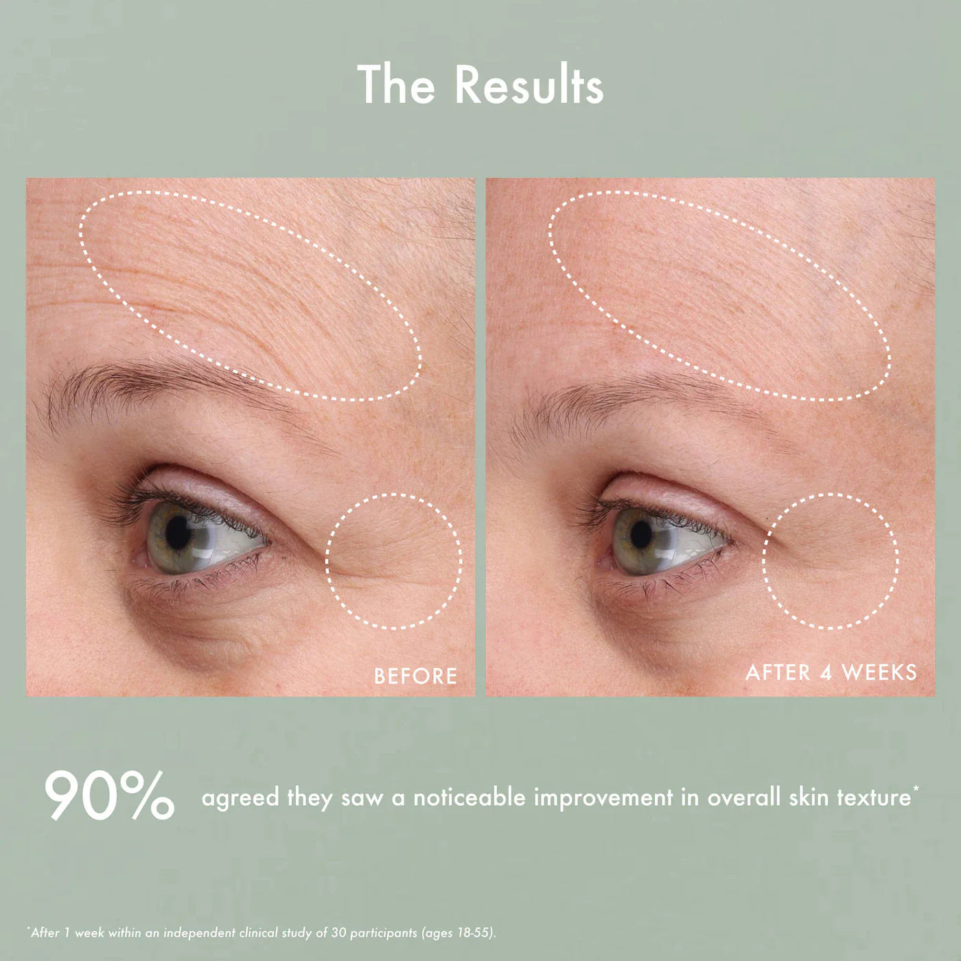 Gentle Reset Daily Exfoliating Pads to Smooth + Minimize Pores with AHAs | SUMMER FRIDAYS