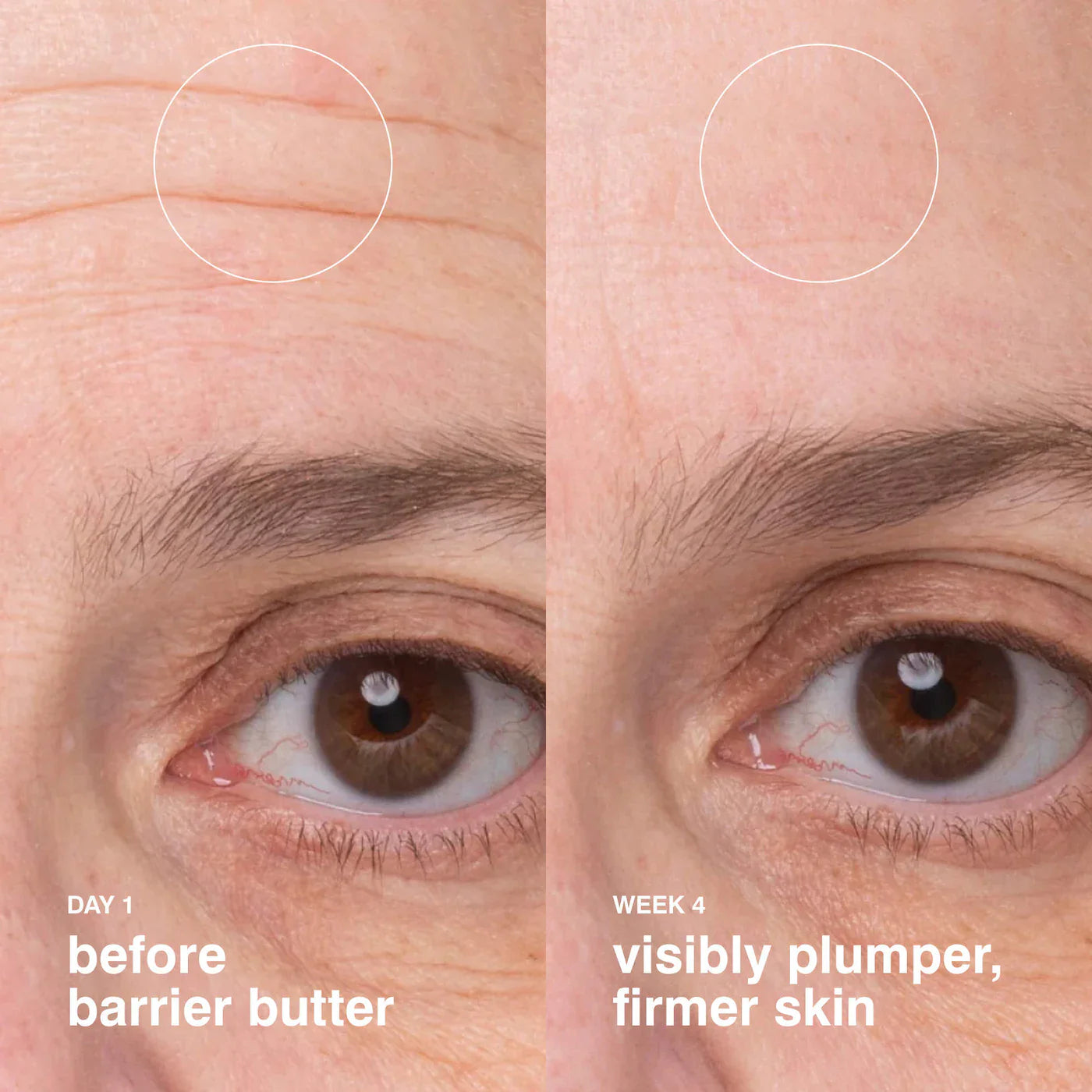 Barrier Butter Intensive Moisture Balm | RHODE