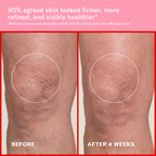 Pink Algae Pro-Retinol Body Butter for Anti-Aging and KP